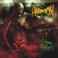 Purchase Anarkhon - Into The Autopsy