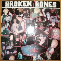 Purchase Broken Bones - Never Say Die (EP)
