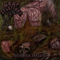 Purchase Meatstretcher - Festering Fecality