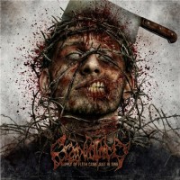Purchase Craniotomy - Supply Of Flesh Came Just In Time