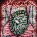 Buy Septicopyemia - Pathophilism - Clinical Necrognosis Mp3 Download
