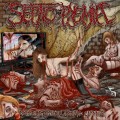 Buy Septicopyemia - Supreme Art Of Genital Carnage Mp3 Download