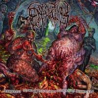 Purchase Epicardiectomy - Abhorrent Stench Of Posthumous Gastrorectal Desecration