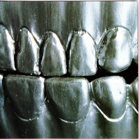 Purchase Change Of Heart - Steel Teeth