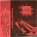 Buy Vomitorial Corpulence - Karrionic Hacktician Mp3 Download