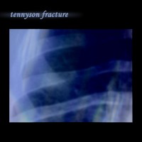 Purchase Seetyca - Tennyson Fracture