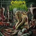 Buy Cerebral Engorgement - Gastrointestinal Bleeding Mp3 Download