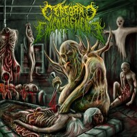 Purchase Cerebral Engorgement - Gastrointestinal Bleeding