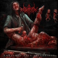 Purchase Astyanax - Embalmed With Afterbirth