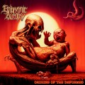 Buy Embryonic Autopsy - Origins Of The Deformed Mp3 Download