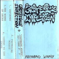 Purchase Grotesque Infection - Festering Wounds (Demo) (Tape)