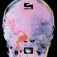 Purchase Upsammy - Branches On Ice (EP)